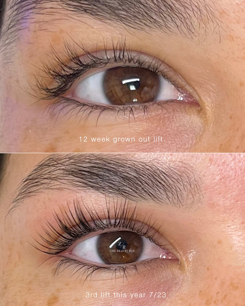 Elleebana Elleeplex Aftercare